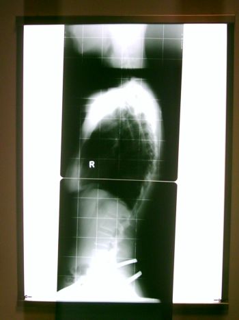 Das Röntgenbild...genial!