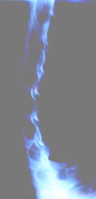 leider schlecht zu sehen, aber es ist die Halswirbelsäule und ein Teil der Brustwirbelsäule