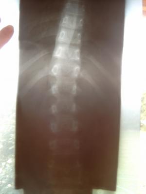 Röntgenfoto meiner Tochter vor zwei Monaten