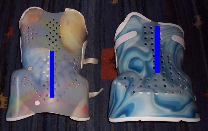 altes und neues Korsett von hinten