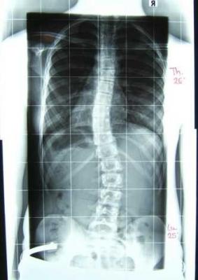 forum_photo-röntgen ohne korsett.jpg