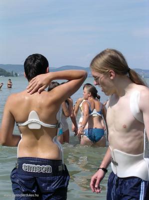 Dieses Anti-Scheuermann-Korsett des "ungarischen Rahmouni" Ferenc Marlok kommt einem "Idealen Kyphose-Korsett" schon sehr nahe!