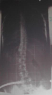 ohne Korsett, 12° und 21 °