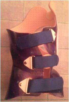 Nachtkorsett (night time brace) vorn