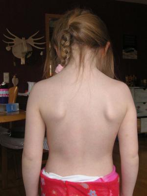 Skoli 02.03.2009.jpg