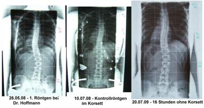 forum_photo-vergleich 3 bilder.jpg
