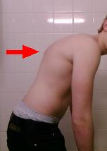 Seitansicht meines Rückens, aktuelles Foto