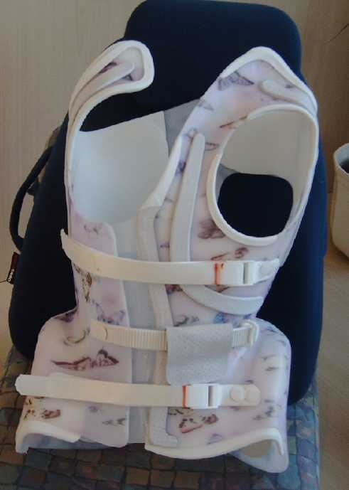 Falls Du eine sehr hochsitzende Thorakale Skoliose hast, dann kann es sein daß Du dieses design bekommst: