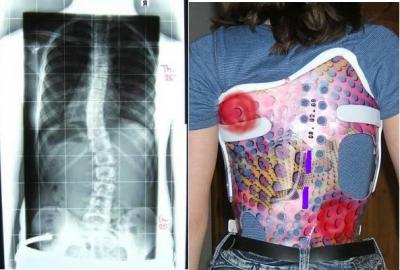 forum_photo-linkskonvex und Pelotten.jpg