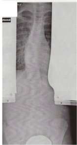 das war das erste bild...34° für mich ein schock