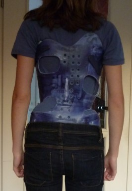 Das ist das Korsett, das sie jetzt trägt, mit 15.