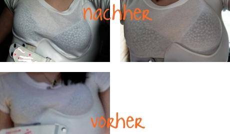 da nochmal der brustbereich.