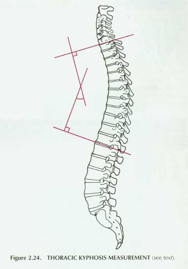 thoracic kyphosis measurement.jpg
