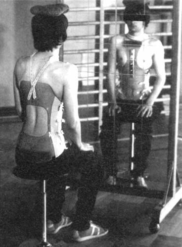 Nochmals "Franz.Schlaufe" am Korsett gegen Kyphose