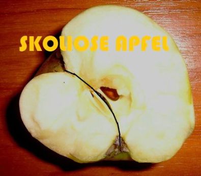 Apfelbild mit Skoliose