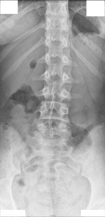 rückenansicht 1.jpg