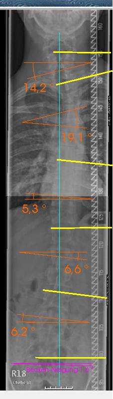 orange = Winkel der gelben Linien