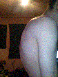 Rücken normale Haltung.gif