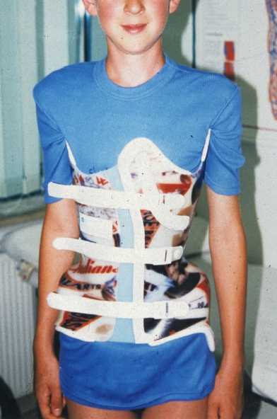 Das ist ein Korsett, in dem man selbst den Oberkörper und die Schultern zurücknehmen muss- OHNE Reklinations-hörnchen