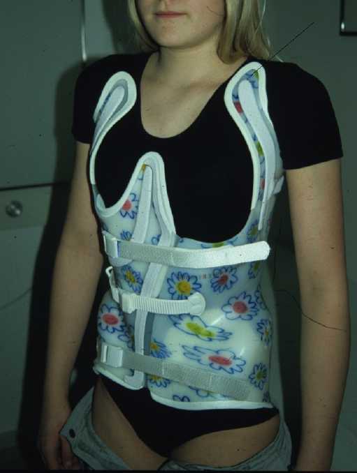 Das ist MIT Reklinationspelotten 
<br />("Schulter-Hörnchen")