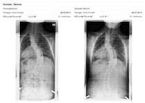 Röntgen juli2013.png