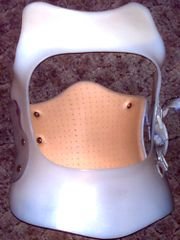Orthese-Bauchfrei-02-180px-Orthese-xs.jpg