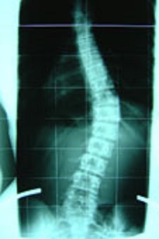 Das könnte meine Wirbelsäule sein - sieht genau so aus