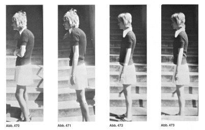 Patientin mit Spasmen durch psychische Probleme.
<br />
<br />Abb. 470: Gewohnheitsmäßige Haltung vor SCHROTH-Reha
<br />Abb. 471: Bestmögliche Haltung vor SCHROTH-Reha
<br />Abb. 472: Gewohnheitsm. Haltung nach SCHROTH-Reha
<br />Abb. 473: Bestmögl. Haltung nach SCHROTH-Reha