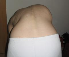 Vorbeugetest VOR Therapiebeginn
