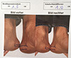 Eigene beinlängendifferenz vorher-nachher