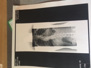aktuelles Röntgenbild