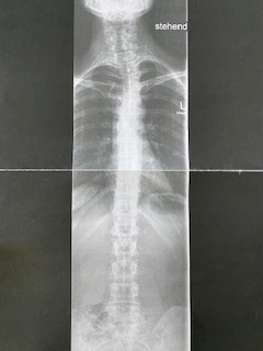 röntgen.jpg