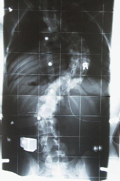 Röbi 14.11 klein.jpg