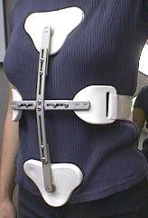 3-Punkt Vogt-Bähler.jpg