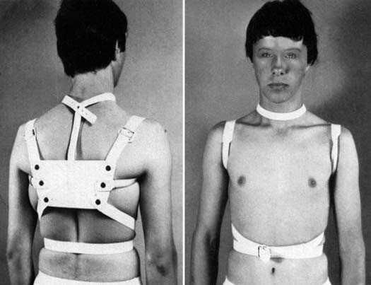 Das ist der einfache "Geradehalter" am Körper mit Franz. Schlinge