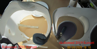 Vergleich Korsett Rahmouni u Skoliomed